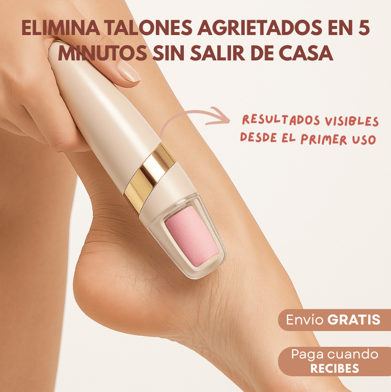 NUEVA Lima Eléctrica: ¡Chau callos!